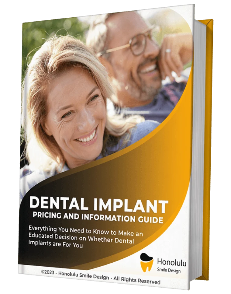 Implants 1 (2) (1)