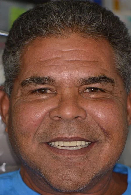 before-after-vertical-001-a