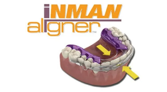 invisalign_box_img_three