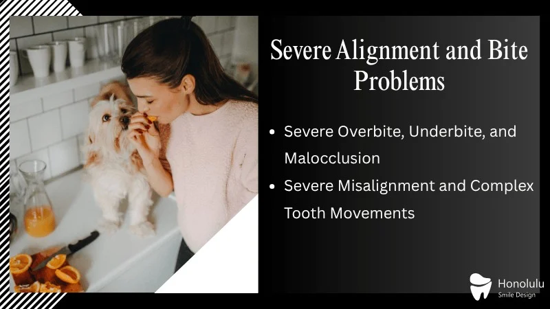 Complex Orthodontic and Bite Issues