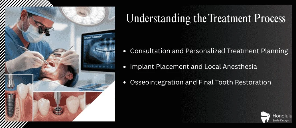 The Dental Implant Treatment Journey