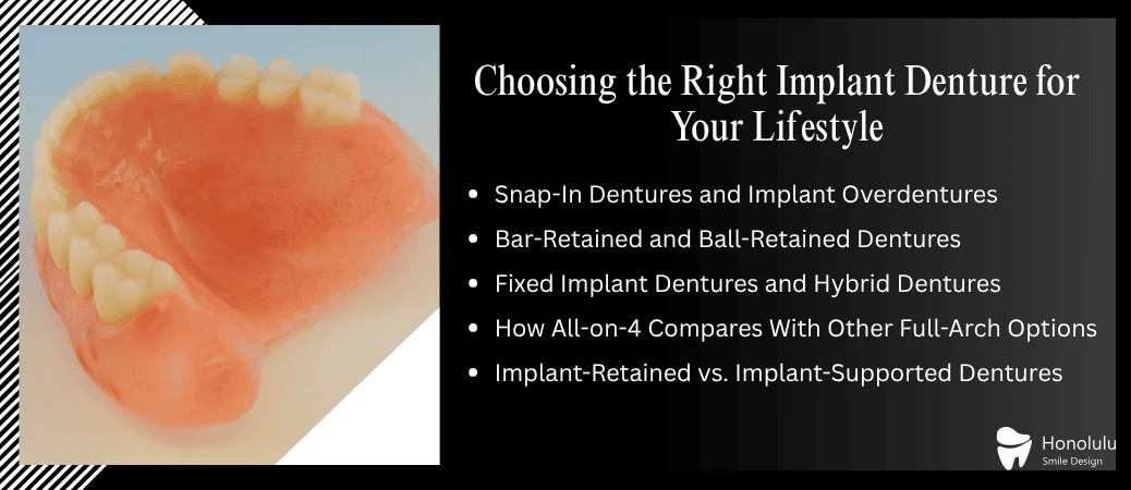 Which Implant Denture Option Fits Your Lifestyle